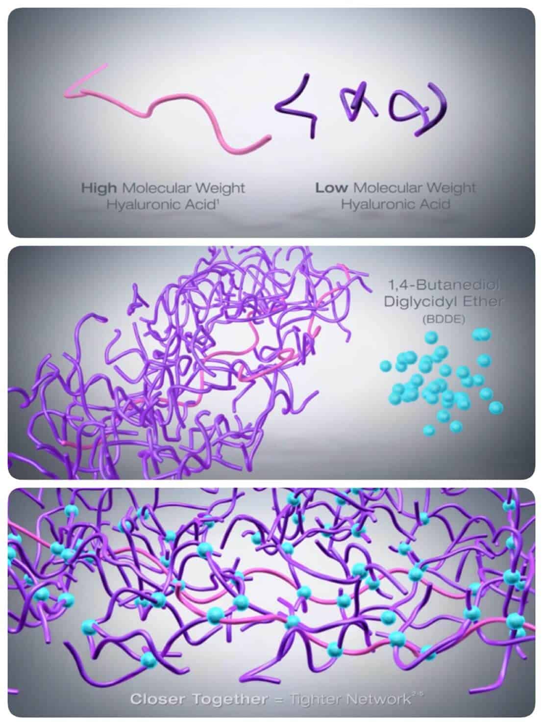 hyaluronic acid(ฟิลเลอร์)