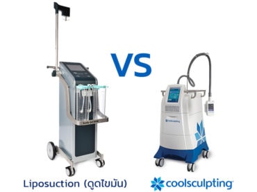 Liposuction VS Coolsculpting