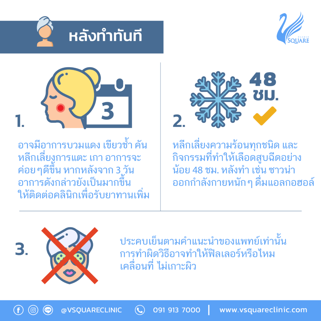 ข้อปฎิบัติหลังฉีดฟิลเลอร์ปาก