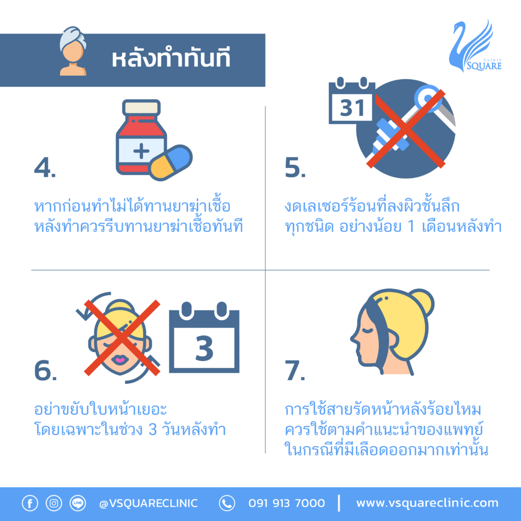 ข้อปฎิบัติหลังฉีดฟิลเลอร์ปาก