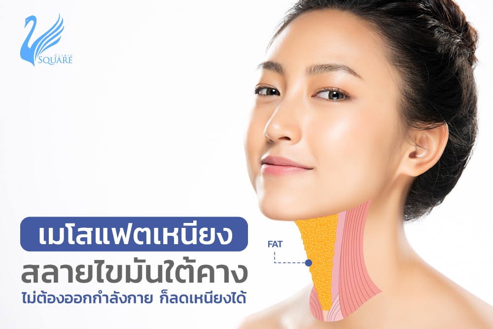 เมโสแฟตสลายเหนียง