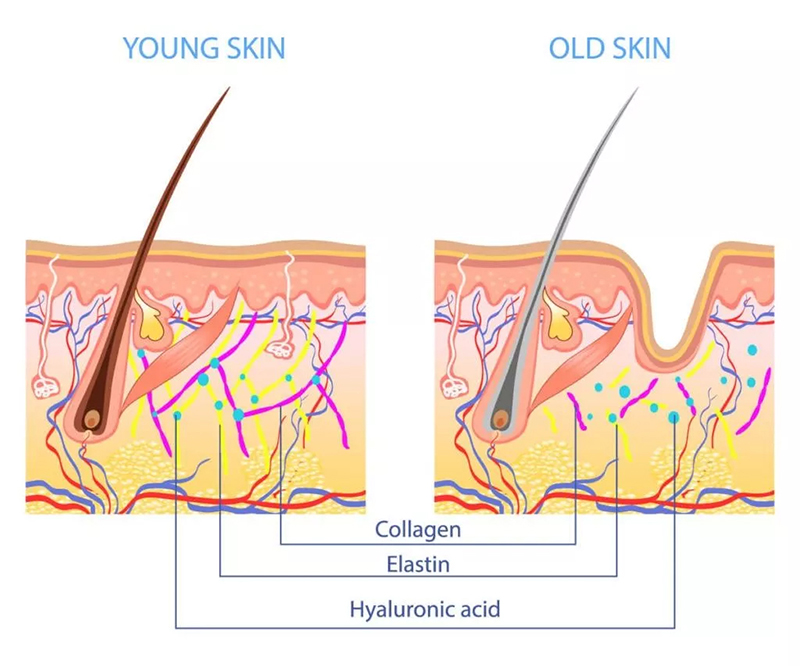 Hyaluronic-Acid-ในชั้นผิว