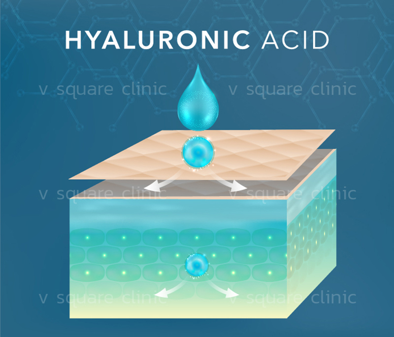 hyaluronic-acid-ฟื้นฟูผิว