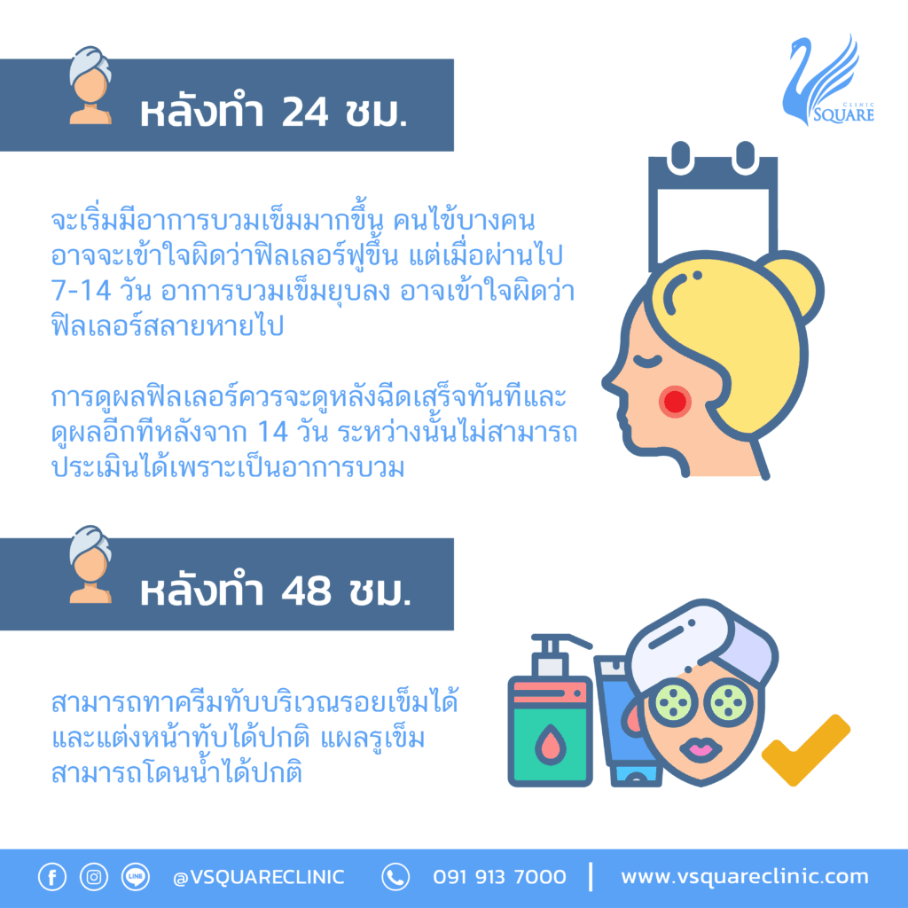 ฉีดฟิลเลอร์ใต้ตา บวมกี่วัน ? ]  มีวิธีปฎิบัติตัวอย่างไรเพื่อให้ฟิลเลอร์เข้าที่เร็วขึ้น