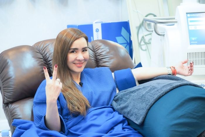 Coolsculpting เหมาะสำหรับใคร