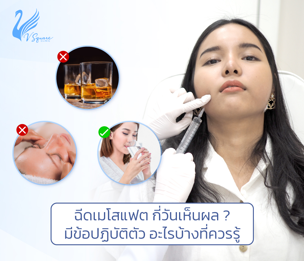 ฉีดเมโสแฟต-กี่วันเห็นผล