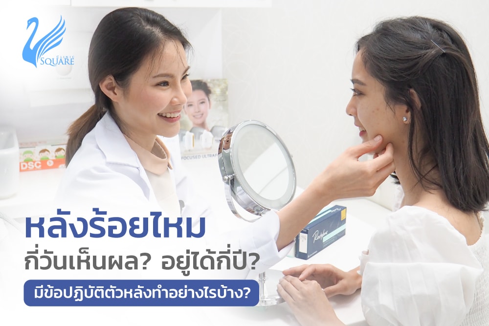 หลังร้อยไหม-กี่วันเห็นผล หลังร้อยไหม-กี่วันเห็นผล