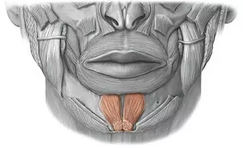 กล้ามเนื้อ mentalis บริเวณคาง