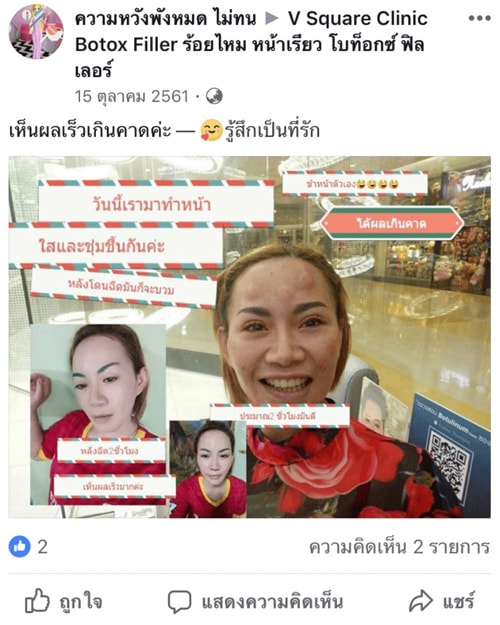 รีวิวฉีดเมโสหน้าใส