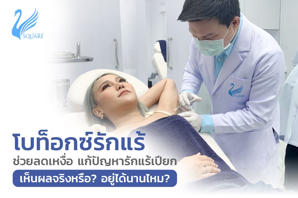 โบท็อกซ์รักแร้