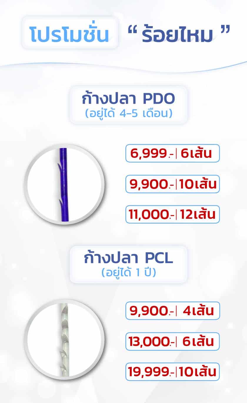โปรโมชั่นร้อยไหม