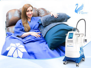 CoolSculpting-คืออะไร_370X277