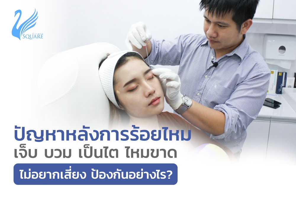ปัญหาร้อยไหม