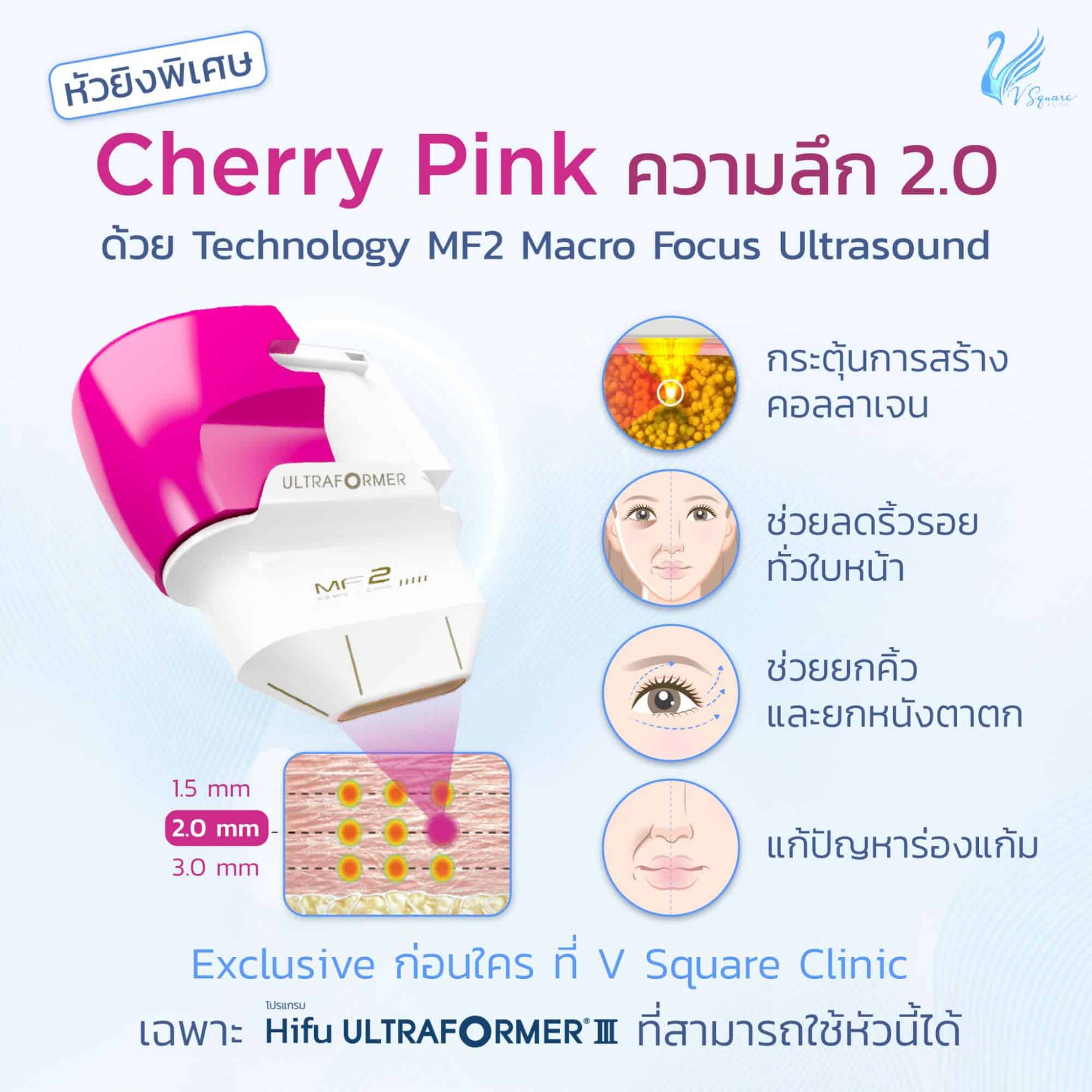 หัวพิเศษ cherry pink