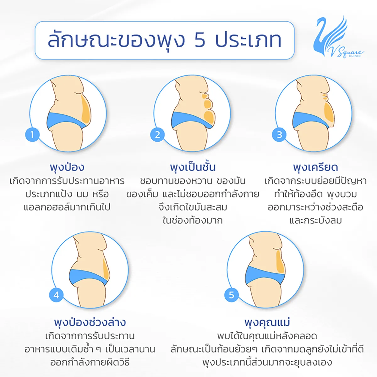 12 วิธีลดพุง ลดหน้าท้อง เลือกทำวิธีไหนเห็นผลจริง เห็นผลเร็ว คุ้มค่ามากที่สุด