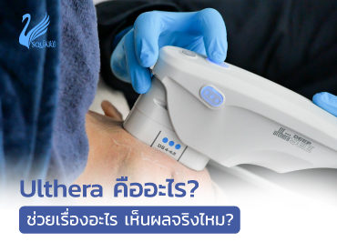 banner-web-Ulthera-คืออะไร-320x277