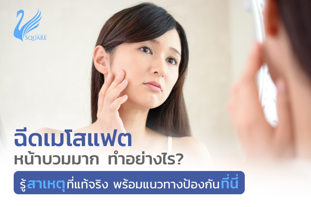 ฉีดเมโสแฟตหน้าบวมทำอย่างไร