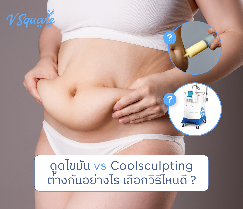 ดูดไขมัน vs coolsculpting