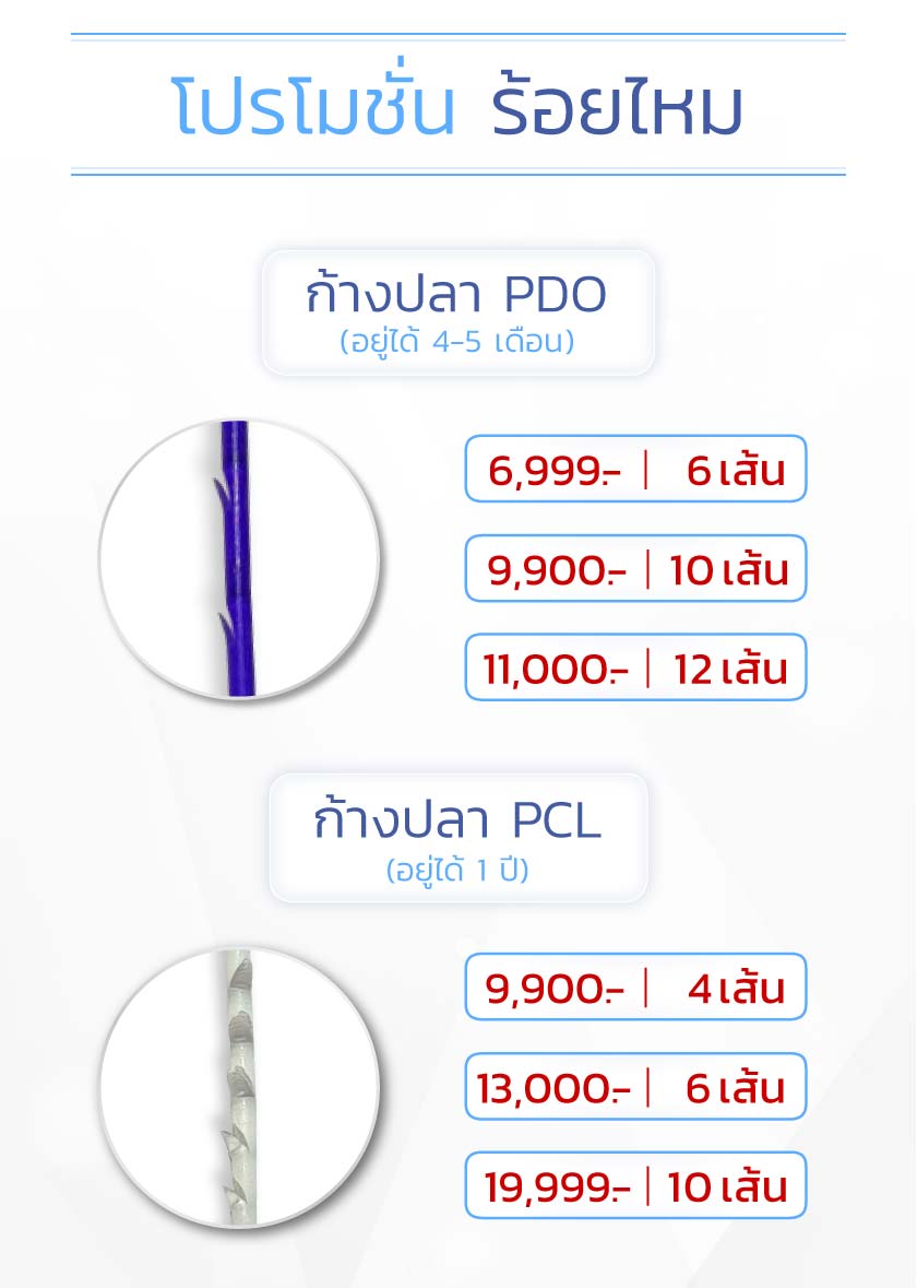 โปรโมชั่นร้อยไหมก้างปลา