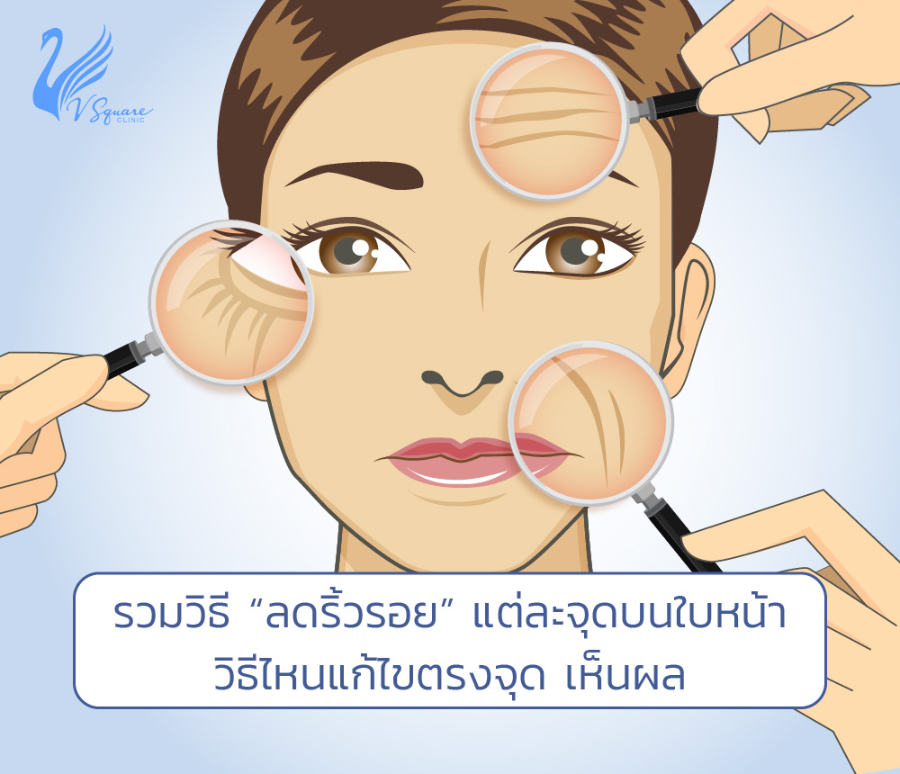 ลดริ้วรอย