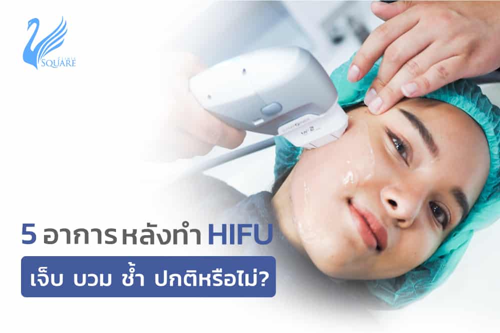 อาการหลังทำHifu