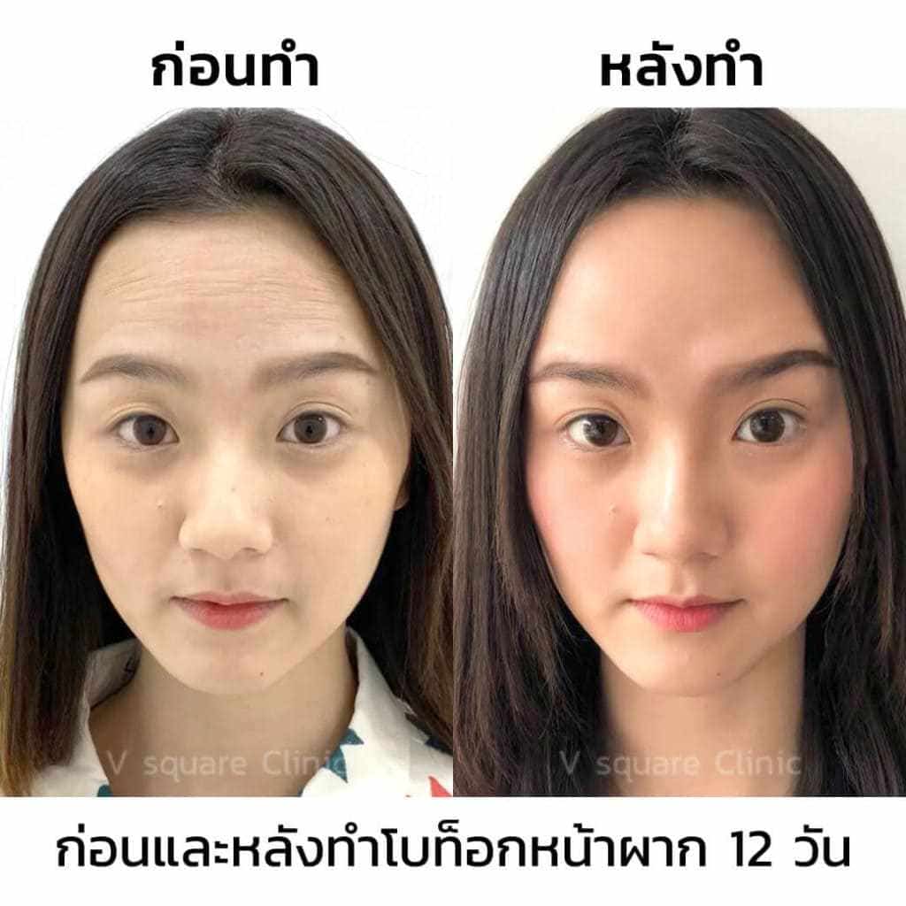 My Image 22