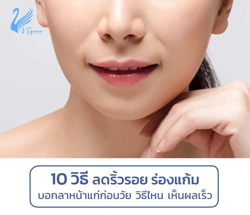 10วิธีลดร่องแก้ม