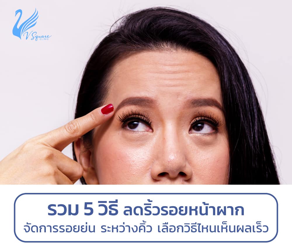 My Image 4