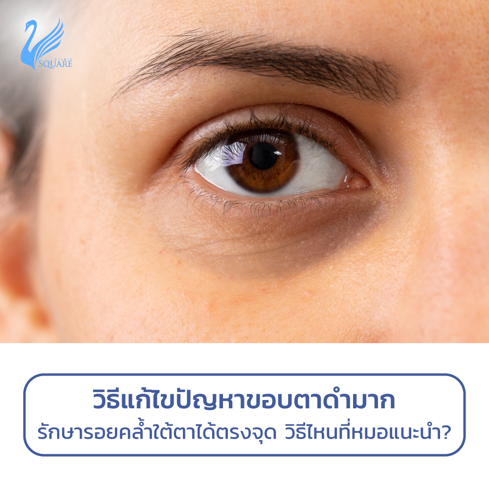My Image 10