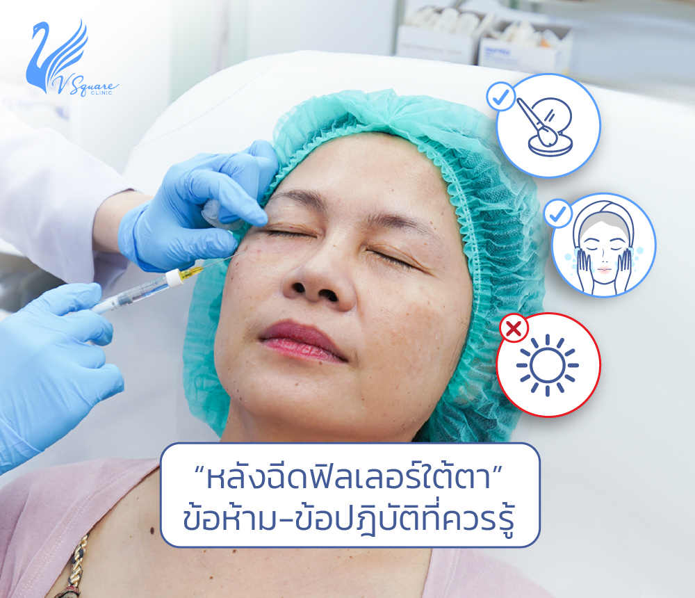 หลังฉีดฟิลเลอร์ใต้ตา-ข้อปฎิบัติและข้อห้าม