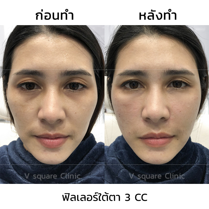 My Image 4