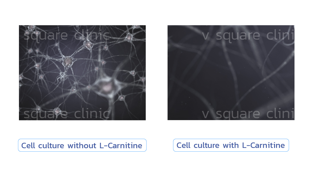 L-carnitine-ทำให้ร่างกายเปลี่ยนไขมันเป็นพลังงาน-(fat-burn)