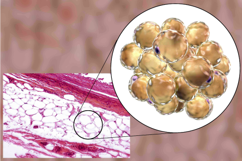 เซลล์ไขมันที่สะสมในร่างกาย