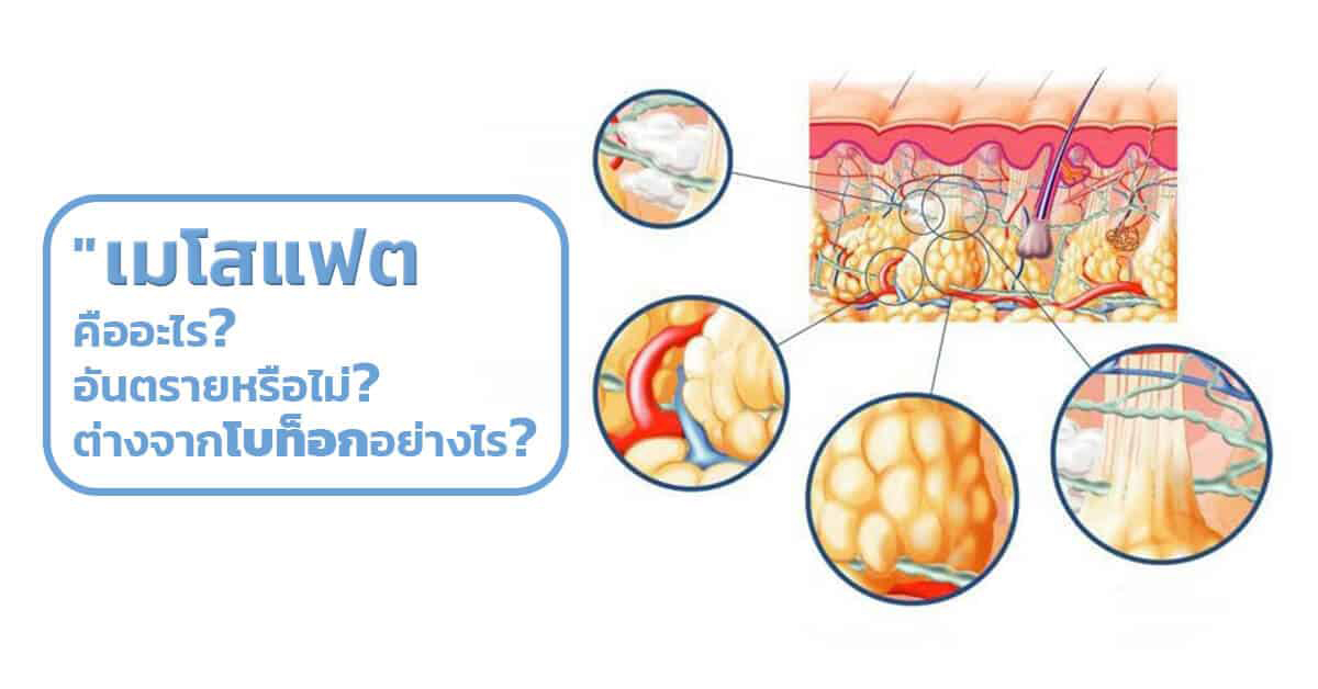 เมโสแฟต