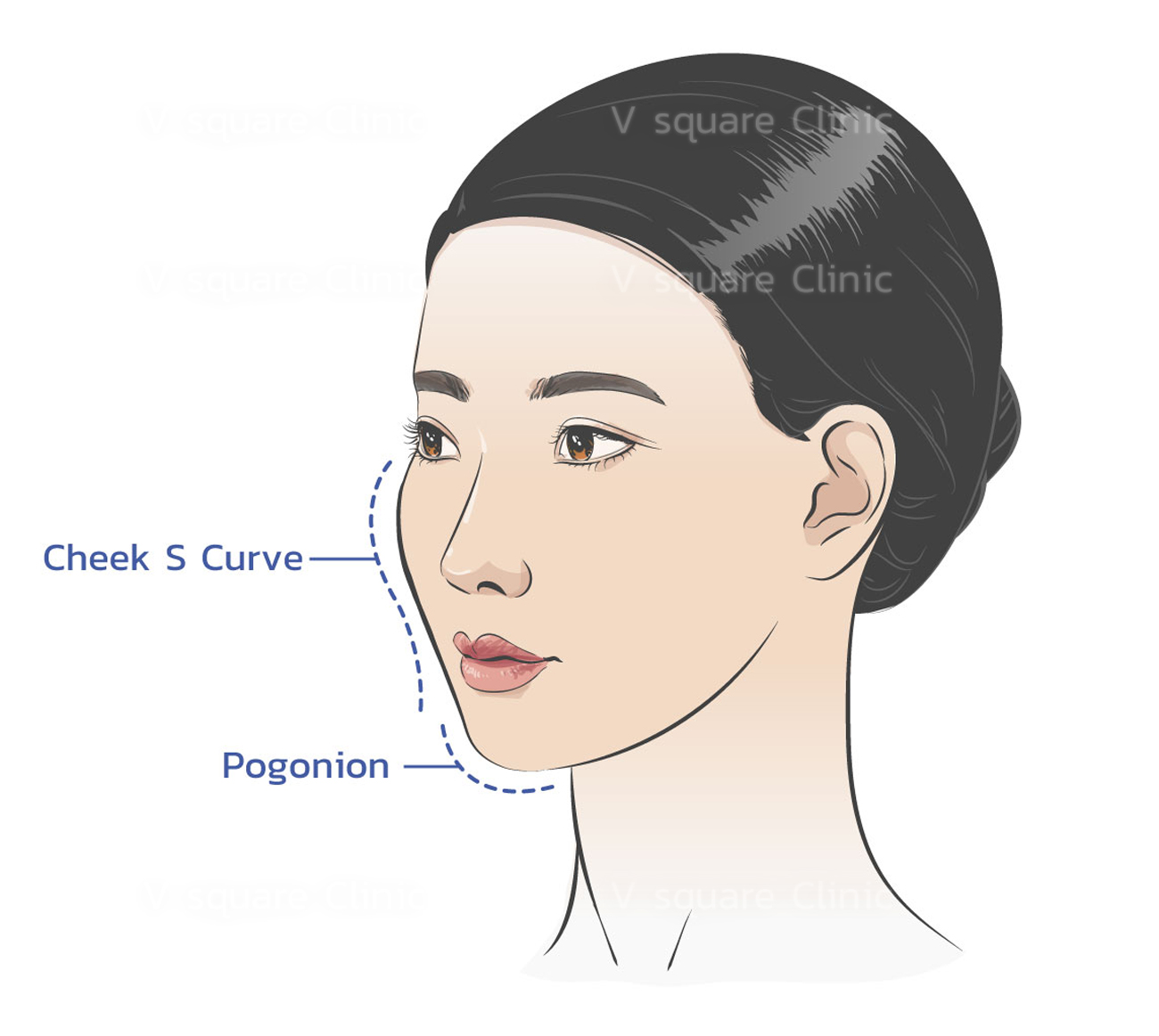 แก้มส้ม-ลักษณะเป็น-S-Curve