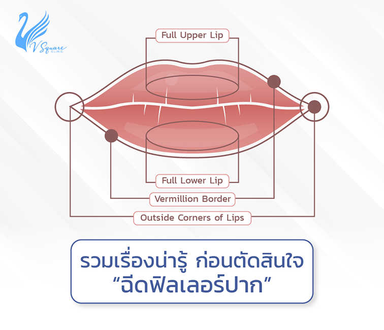 ฉีดฟิลเลอร์ปาก