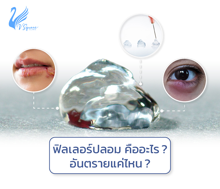 ฟิลเลอร์ปลอม-คืออะไร