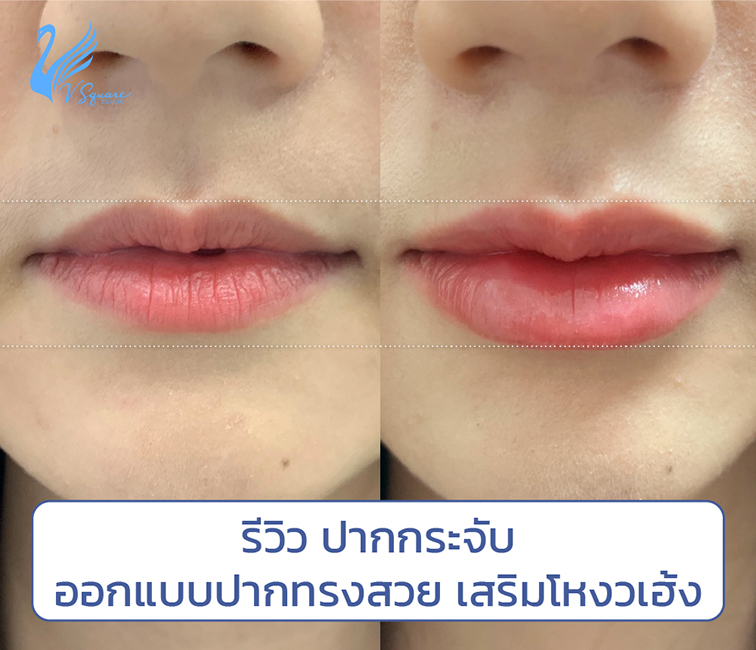 รีวิวปากกระจับ-ออกแบบปากทรงสวย-เสริมโหงวเฮ้ง