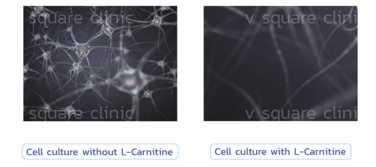 ในเมโสแฟตมี-L-carnitine