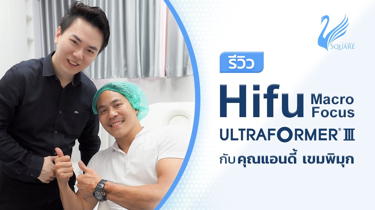 คุณแอนดี้ ทำ Hifu Ultraformer III ที่ V Square Clinic 