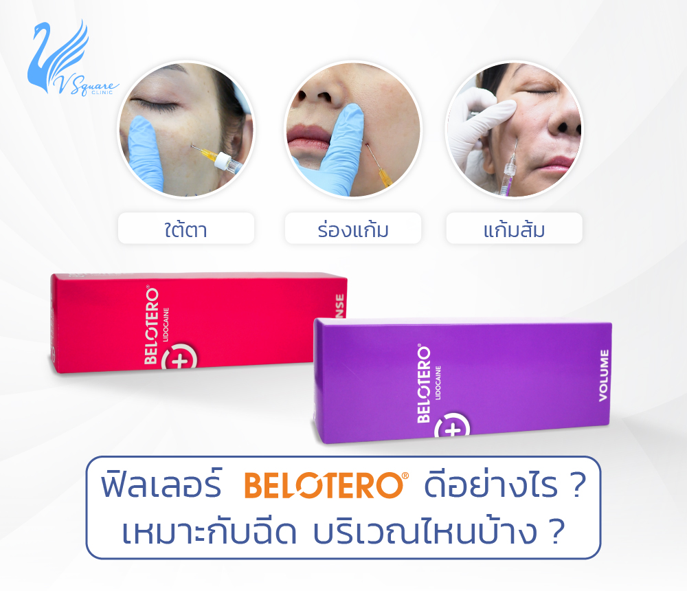 ฟิลเลอร์-Belotero