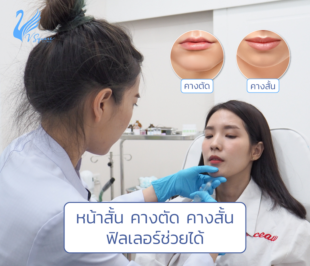 วิธีแก้ปัญหา-คางสั้น-คางตัด-คางบุ๋ม