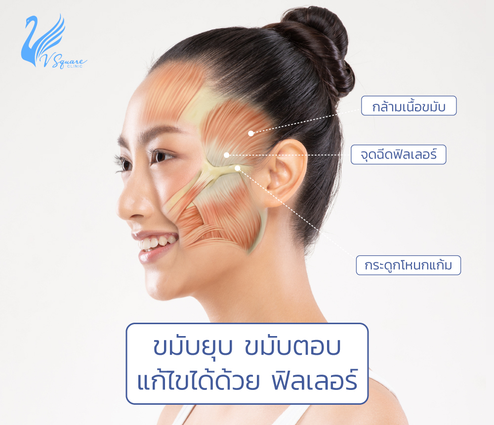 My Image 35