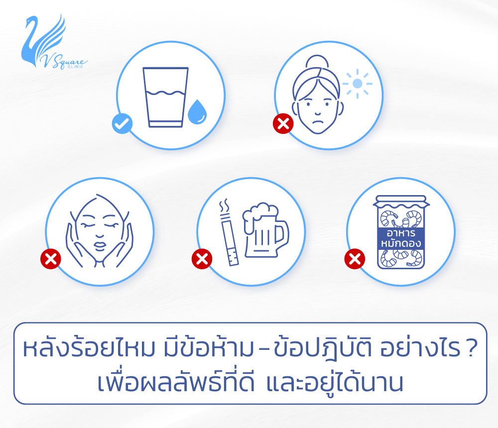 ข้อห้าม-ข้อปฎิบัติหลังร้อยไหม วิธีดูแลตัวเองให้ได้ผลลัพธ์ที่ดีและอยู่ได้นาน ข้อห้าม-ข้อปฎิบัติหลังร้อยไหม วิธีดูแลตัวเองให้ได้ผลลัพธ์ที่ดีและอยู่ได้นาน