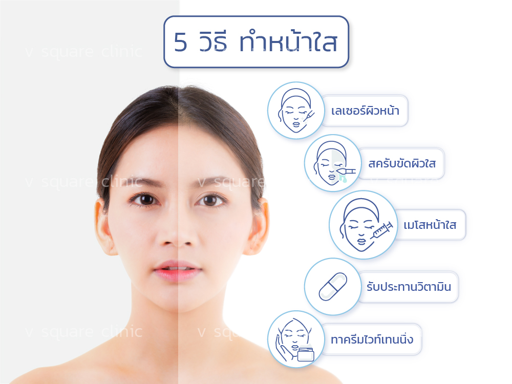 5 วิธีทำหน้าใส แก้ปัญหาผิวหมองคล้ำ หน้าใสขึ้น หน้าเนียนขึ้น  อย่างเป็นธรรมชาติ