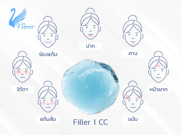 ฟิลเลอร์ 1 CC