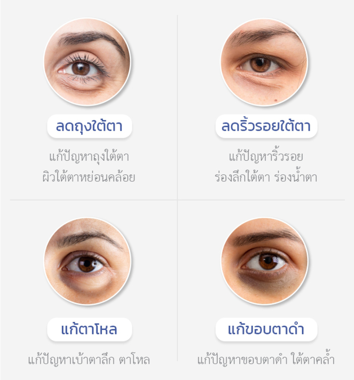 ฟิลเลอร์ใต้ตา-ราคาคุ้มค่าเมื่อเทียบกับผลลัพธ์ที่ได้