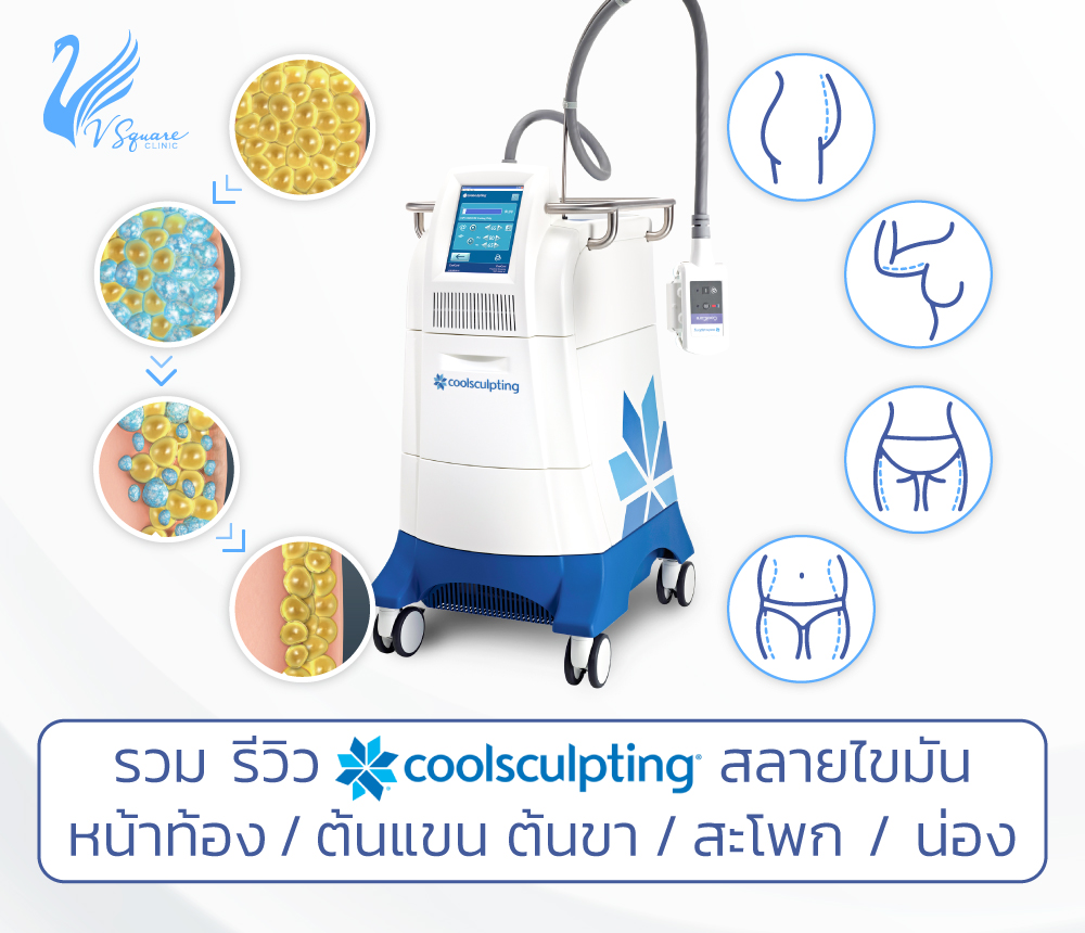 รูปบทความ_รีวิว-CoolSculpting-วิธีการสลายไขมันด้วยความเย็นเพื่อหุ่นสวย-เฟิร์ม-เข้ารูป-1000x860