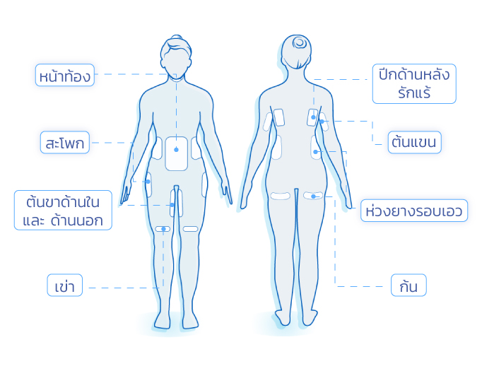 ส่วนที่เหมาะกับการทำ Coolsculpting