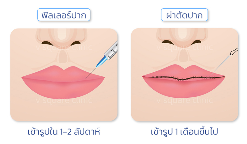 ทําปากกี่เดือนเข้าที่